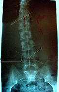 Before X-ray